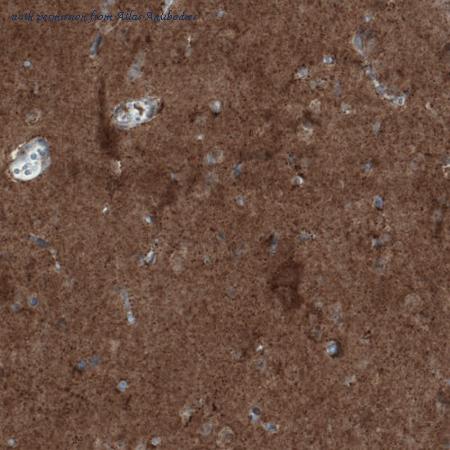 Atlas Antibodies AMAb90852 image 2