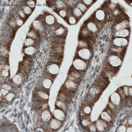Atlas Antibodies AMAb90852 image 3
