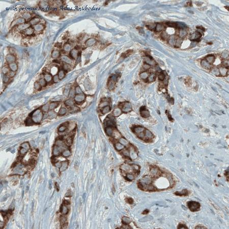 Atlas Antibodies AMAb90859 image 2
