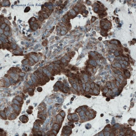 Atlas Antibodies AMAb90859 image 3