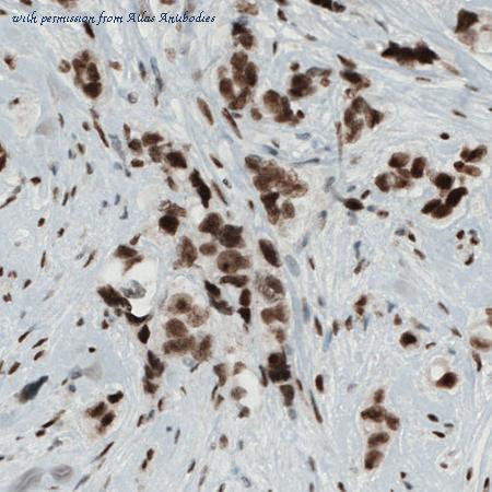 Atlas Antibodies AMAb90860 image 1