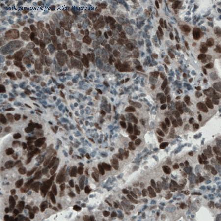 Atlas Antibodies AMAb90860 image 2