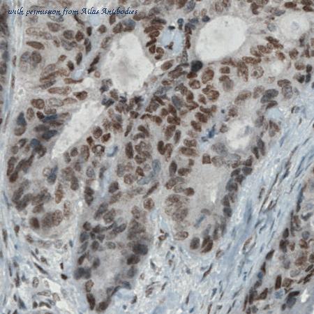 Atlas Antibodies AMAb90860 image 3