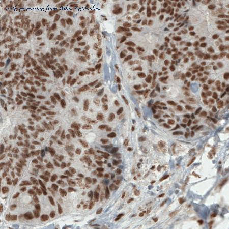 Atlas Antibodies AMAb90872 image 1