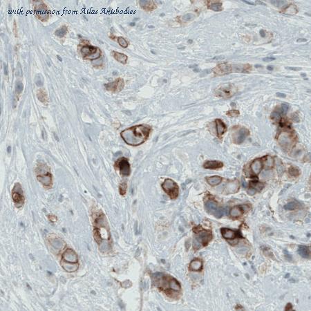 Atlas Antibodies AMAb90890 image 1