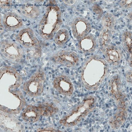 Atlas Antibodies AMAb90890 image 3