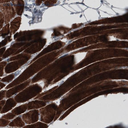 Atlas Antibodies AMAb90947 image 1