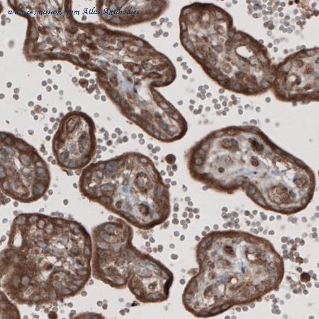 Atlas Antibodies AMAb90971 image 1