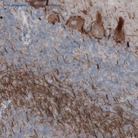 Atlas Antibodies AMAb91025 image 1