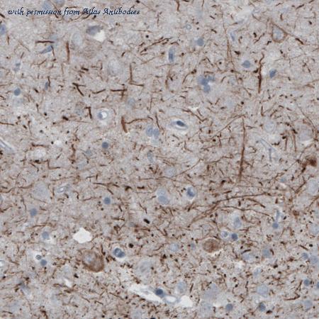 Atlas Antibodies AMAb91025 image 2