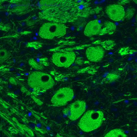 Atlas Antibodies AMAb91030 image 1