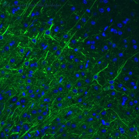 Atlas Antibodies AMAb91030 image 2