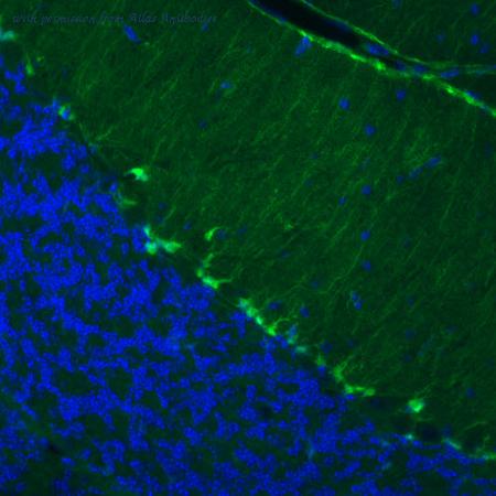 Atlas Antibodies AMAb91038 image 2