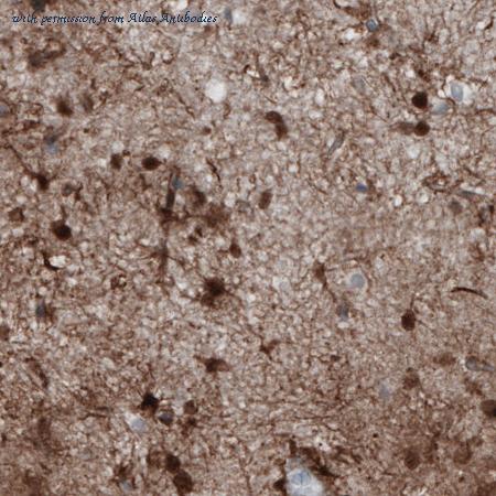 Atlas Antibodies AMAb91038 image 3