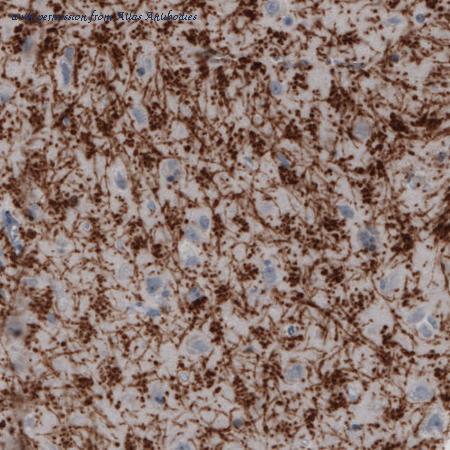 Atlas Antibodies AMAb91064 image 3