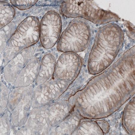 Atlas Antibodies AMAb91098 image 2