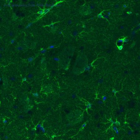 Atlas Antibodies AMAb91103 image 1