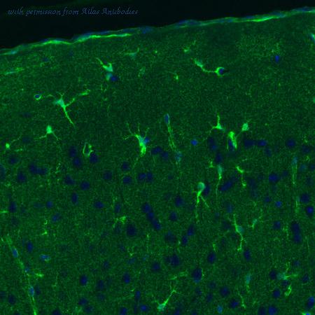 Atlas Antibodies AMAb91103 image 2