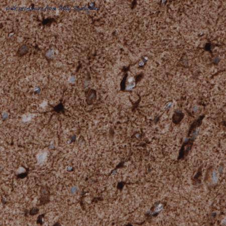 Atlas Antibodies AMAb91103 image 3