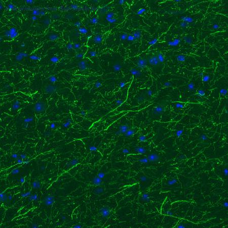 Atlas Antibodies AMAb91108 image 2