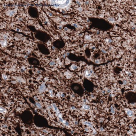 Atlas Antibodies AMAb91108 image 3