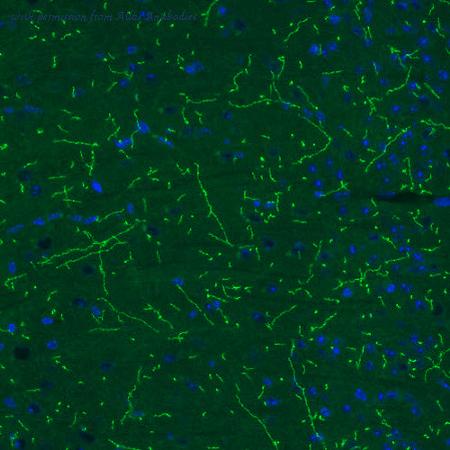 Atlas Antibodies AMAb91116 image 2