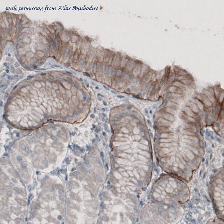 Atlas Antibodies AMAb91123 image 1