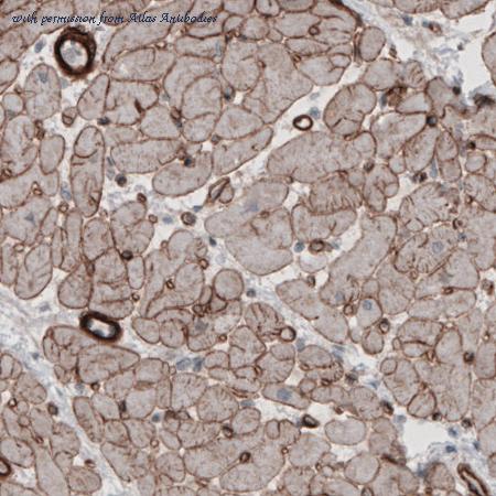 Atlas Antibodies AMAb91124 image 3