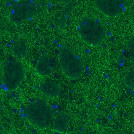 Atlas Antibodies AMAb91125 image 1
