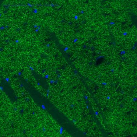 Atlas Antibodies AMAb91125 image 2