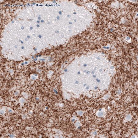 Atlas Antibodies AMAb91125 image 3