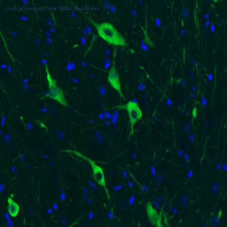 Atlas Antibodies AMAb91130 image 1