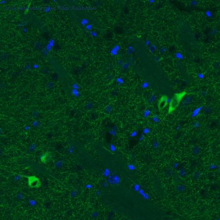 Atlas Antibodies AMAb91130 image 2