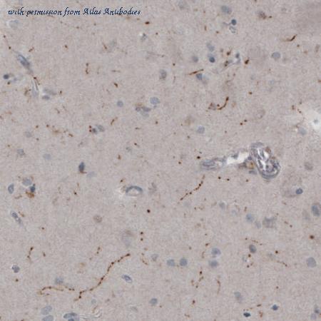 Atlas Antibodies AMAb91130 image 3