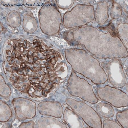 Atlas Antibodies AMAb91138 image 1