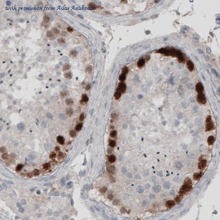 Atlas Antibodies AMAb91141 image 1