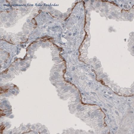 Atlas Antibodies AMAb91160 image 1