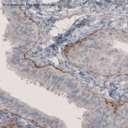 Atlas Antibodies AMAb91160 image 3