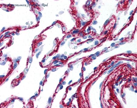 Bio-Rad AHP2049 image 1