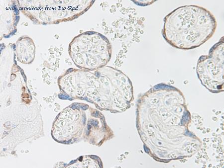Bio-Rad AHP300G image 1