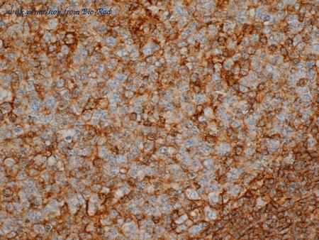 Bio-Rad MCA2504 image 1
