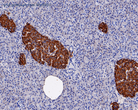 HUABIO 0908-2 image 2