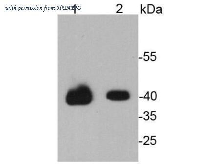HUABIO EM100306 image 2
