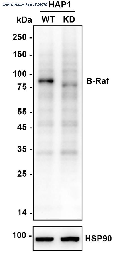HUABIO EM1701-32 image 2