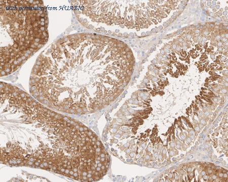 HUABIO EM1701-32 image 3