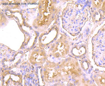 HUABIO EM1701-36 image 2