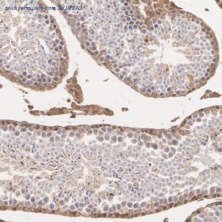 HUABIO EM1701-41 image 2