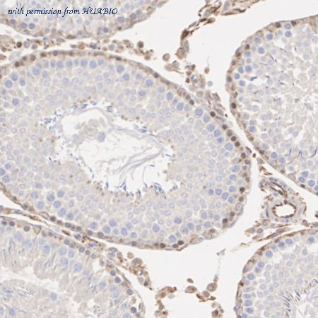 HUABIO EM1701-41 image 3