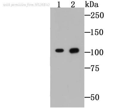 HUABIO EM1701-43 image 2