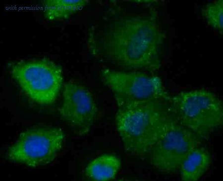 HUABIO EM1701-43 image 3